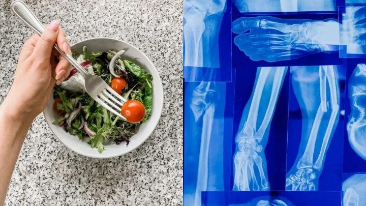 ¿Qué comer si tienes osteoporosis? 6 Alimentos para fortalecer tus huesos