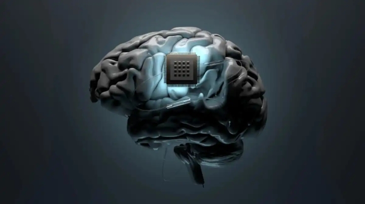 Synchron implanta con éxito un chip cerebral