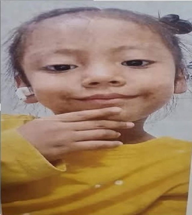 Desaparece niña de cinco años en Yecapixtla