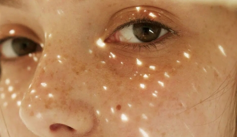 ¡Protege tu piel! Evita las manchas del sol con estos 5 consejos