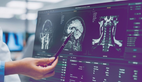 Tecnología de precisión revoluciona la neurocirugía y la reparación nerviosa