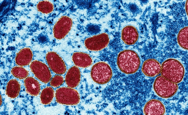 Mapa de la viruela del mono: Así avanza el virus en el mundo