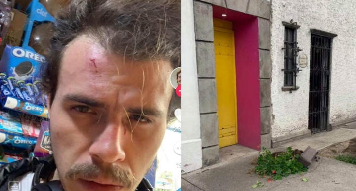 Le cae maceta en Coyoacán y narra el incidente en TikTok