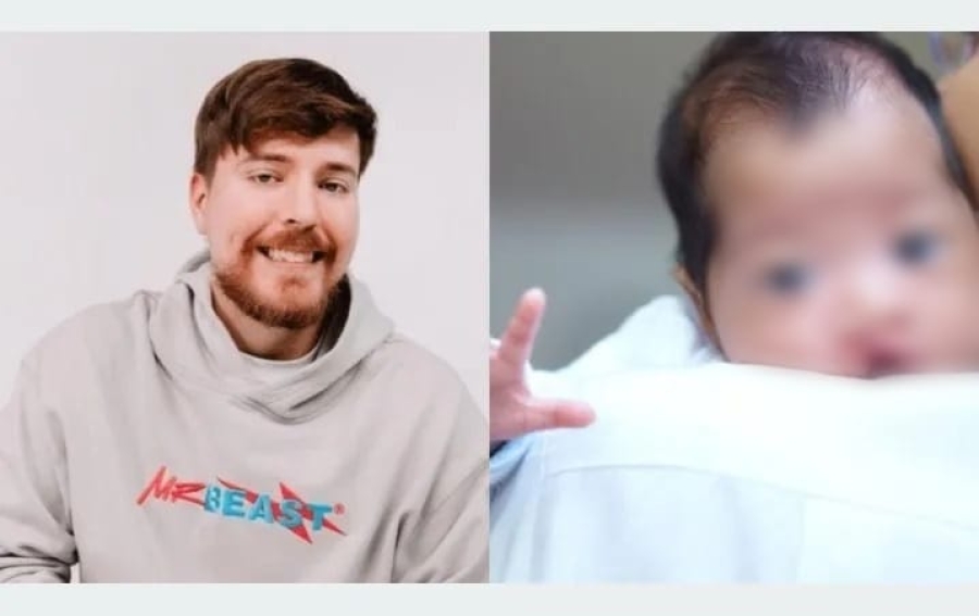 Mr. Beast dona 100 cirugías a niños mexicanos con labio leporino