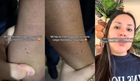 Madre denuncia en TikTok presunto maltrato físico de la novia de su hijo: &#039;La violencia no tiene género&#039;