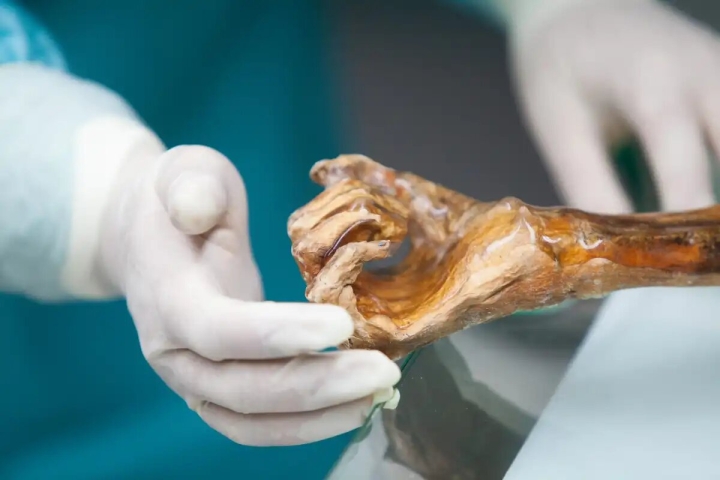 Ötzi, el Hombre de los Hielos: estudio revela era calvo y de piel oscura