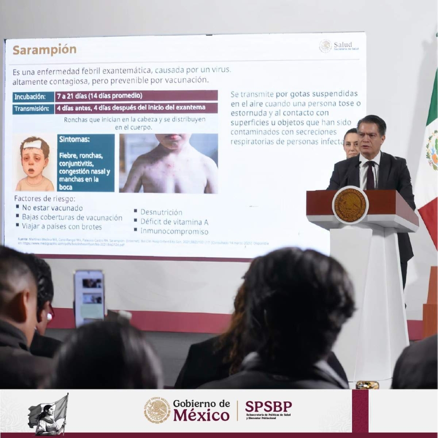 Atienden alerta por sarampión en el país 