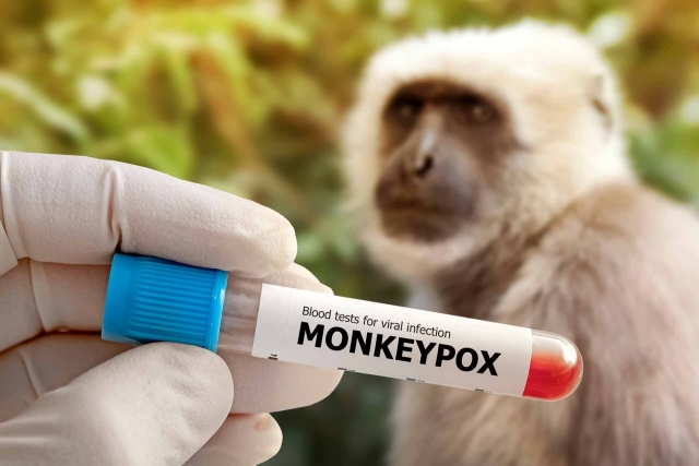 Viruela del mono: Detectan nueva variante en la India