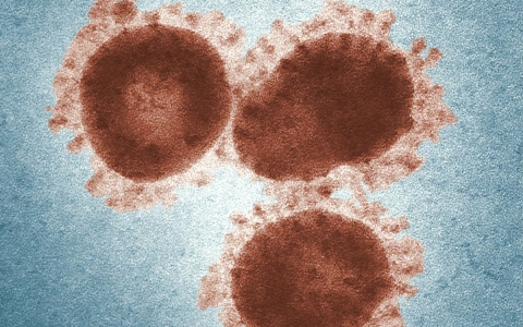 México registra 4 muertes y más de 1,600 casos de sarampión este 2025