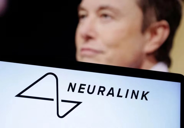 Paciente con chip de Neuralink comparte su experiencia por primera vez