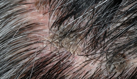 Hair Center of Turkey