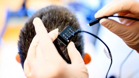 Nueva IA ayuda a mujer con parálisis a comunicarse casi en tiempo real