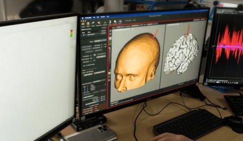 Gabe Newell desafía a Neuralink con un chip cerebral pequeño, sin batería y orientado a la salud