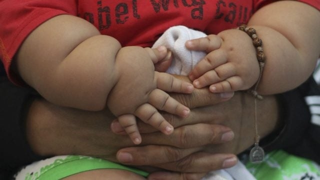 Pediatras de EU aconsejan medicación y cirugía contra la obesidad infantil