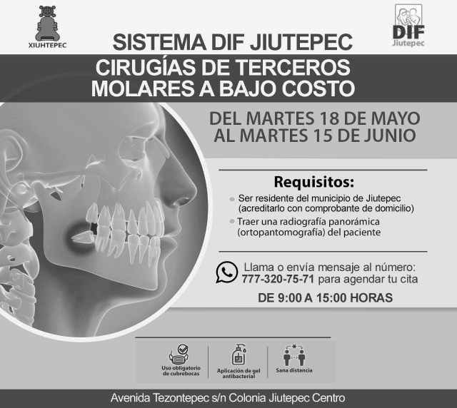 Ofrece DIF Jiutepec extracciones de &#039;muelas del juicio&#039; a bajo costo