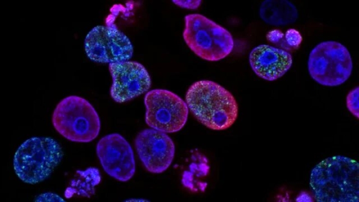 Desarrollan nueva molécula para el tratamiento contra el cáncer