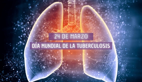 Día Mundial de la Tuberculosis: una lucha global contra la enfermedad