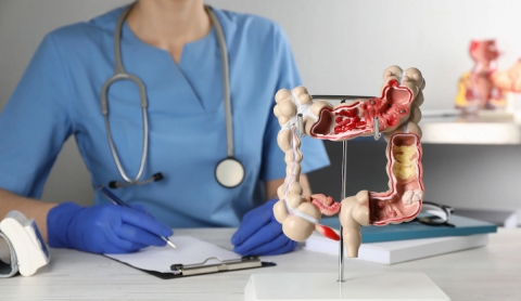 Vitamina D, clave en la prevención del cáncer de colon en adultos jóvenes