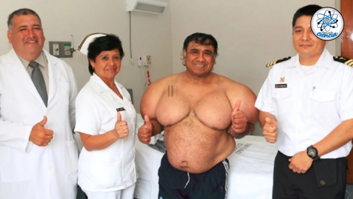 VIDEO ¿Qué ha sido de Alejandro Ramos, el buzo peruano que se deformo en 2013 tras sumergirse en el agua?