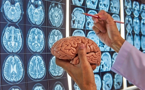 Sueño deficiente puede acelerar el envejecimiento cerebral