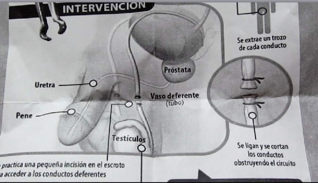 Las autoridades anunciaron diversas jornadas de vasectomía en centros de salud de la región sur para este mes.