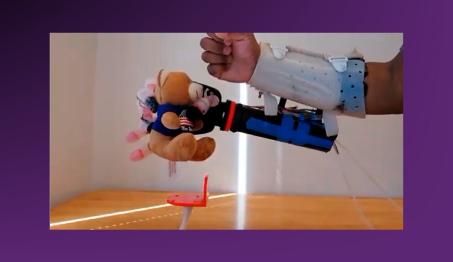 Desarrollan mano biónica con inteligencia artificial para control preciso y percepción táctil