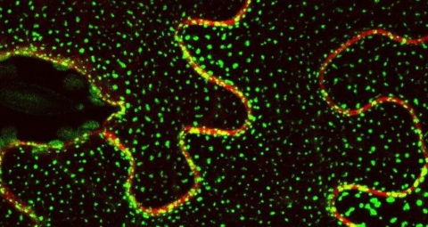 Imagen de microscopía confocal con la localización de la proteína Sinaptotagmina 1 unida a la proteína fluorescente GFP.