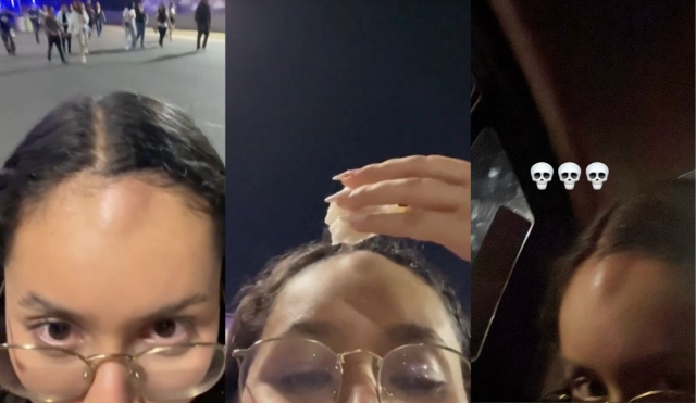 Fan recibe fuerte golpe con baqueta lanzada por baterista de Morat durante el Tecate Emblema | VIDEO