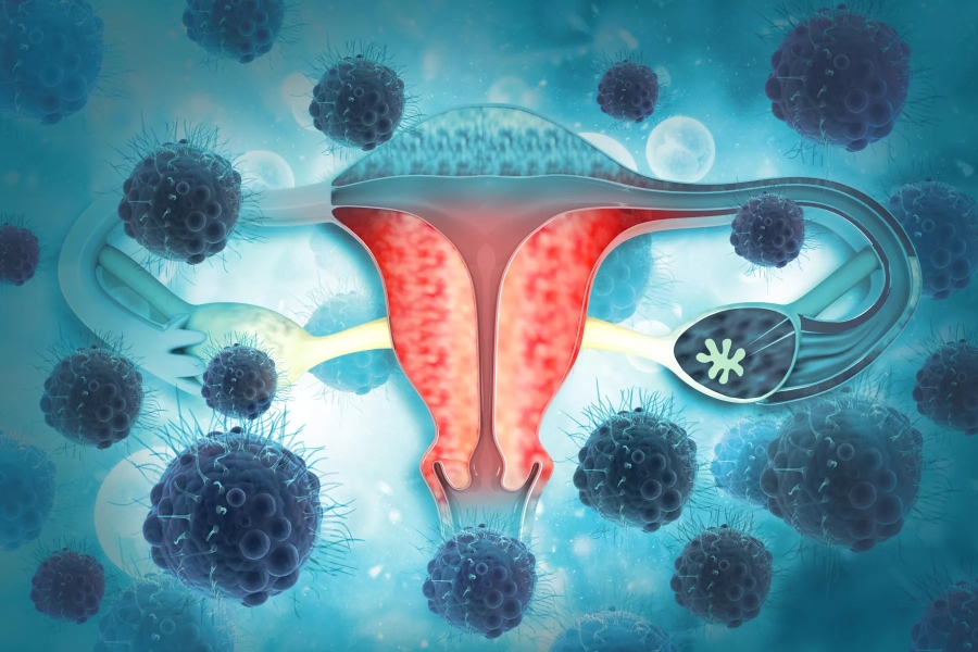 Receta para no morir de cáncer cervicouterino