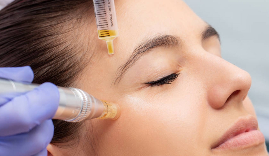 Fibroblastos para rejuvenecer el rostro: el tratamiento natural que estimula tu piel desde dentro