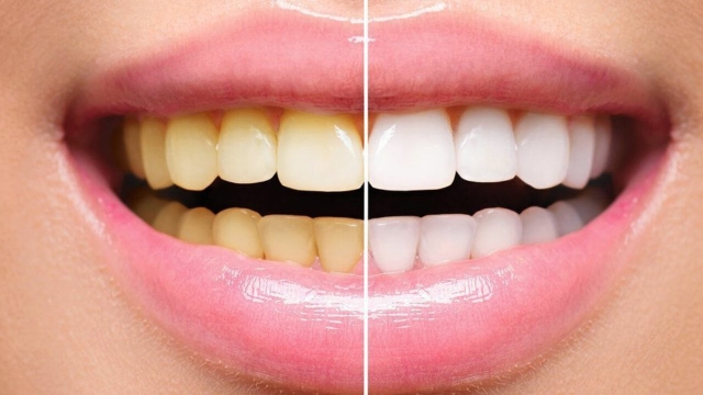 Seis alimentos comunes que manchan los dientes y cómo prevenirlo