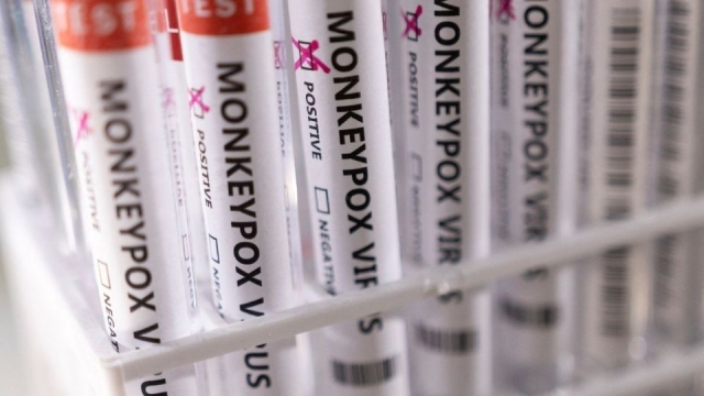 Viruela del mono: En México no se han identificado casos, informó la Ssa