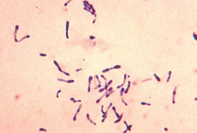 Mueren 25 personas por brote de difteria en Nigeria