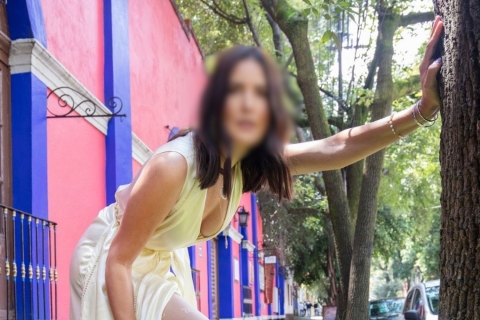 Influencer brasileña alerta sobre tratamientos estéticos tras sufrir graves quemaduras en el rostro