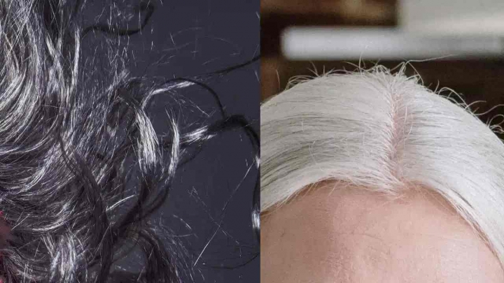 ¿Tienes canas? Podrías tener problemas de salud según la UNAM