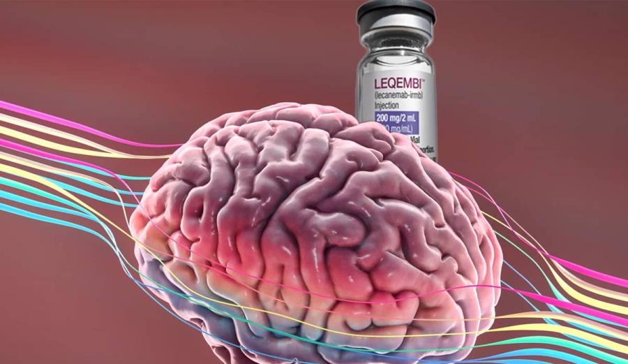 Autoriza Cofepris medicamento innovador contra Alzheimer