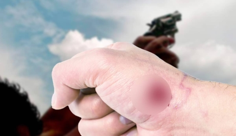 Resultó herido a causa de una bala perdida