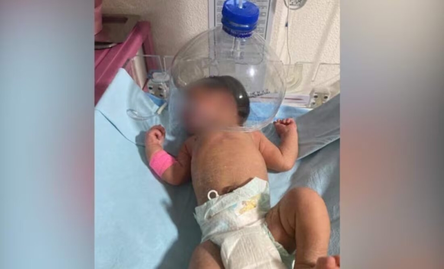 Por falta de insumos, usan botella como casco cefálico para bebé en IMSS-Bienestar Tabasco