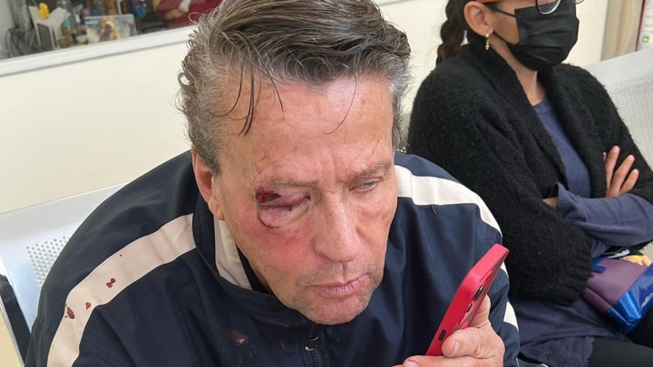 Alfredo Adame narra cómo lo agredieron: ‘El tipo me golpeó con una piedra’