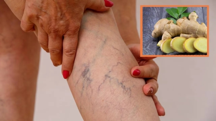 Te contamos cómo puedes usar el jengibre para ayudar a la circulación de la sangre de tus piernas y evitar las varices