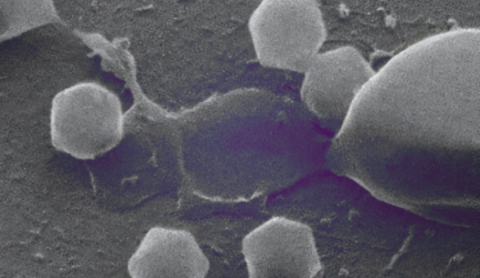 Descubren por casualidad un virus gigante en Finlandia